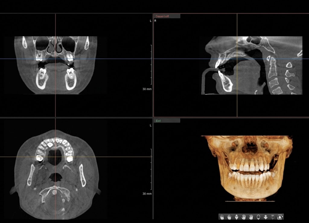 精密檢查及CT攝影