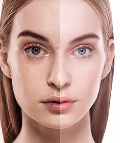 適當的頰側走廊