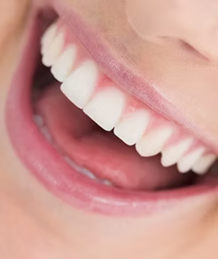 整齊的牙齒排列