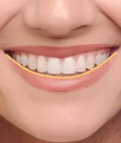 對稱協調的笑容