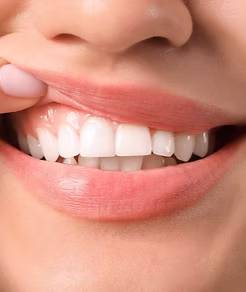 牙齒與牙齦的適當露出量