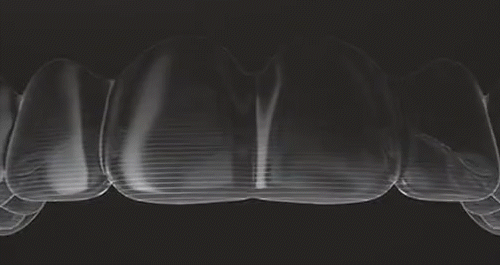 依牙齦線客製化製作