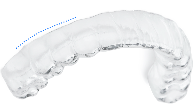 一般透明矯正裝置