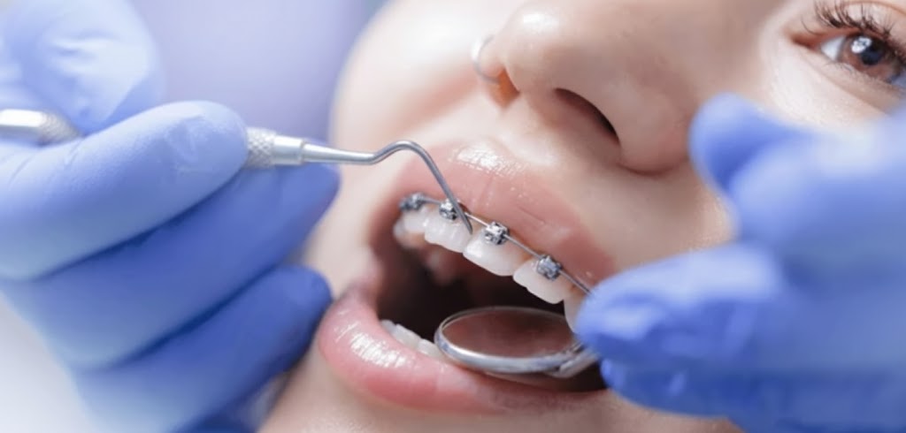 サージェリーファースト矯正